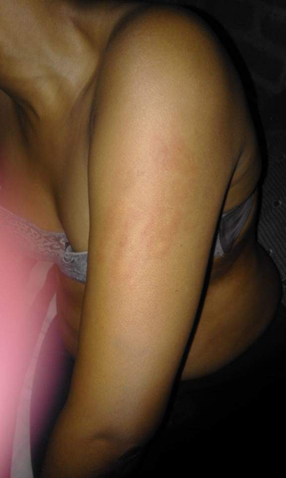 Severely Battered Woman Yolo Pityana Shows Brutalized Body
