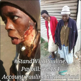 Kenyan Woman Pauline Mugure Set Her On Fire By Husband In Violent Domestic Abuse Attack