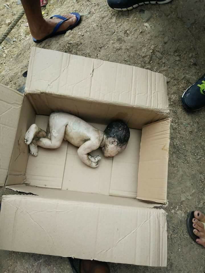 Newborn Baby Girl Abandoned In A Box And Found In Sewage