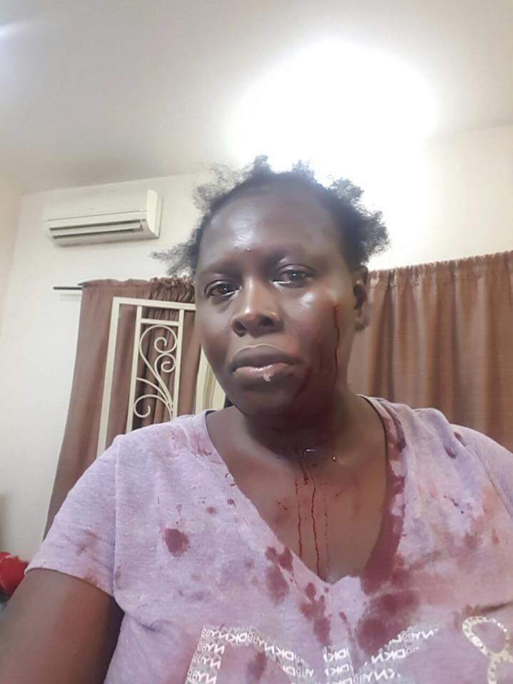 Tonye Thom-Manuel Brutally Batters Wife Of 10 Years And Mother Of 3 Preye In Domestic Violence