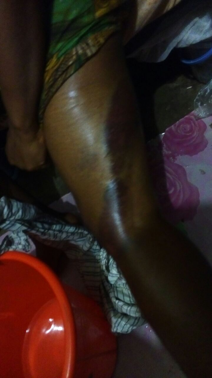 How A Lecturer In Sociology Dept Kogi State University Physically Abused Female Student He Was Having An Affair With