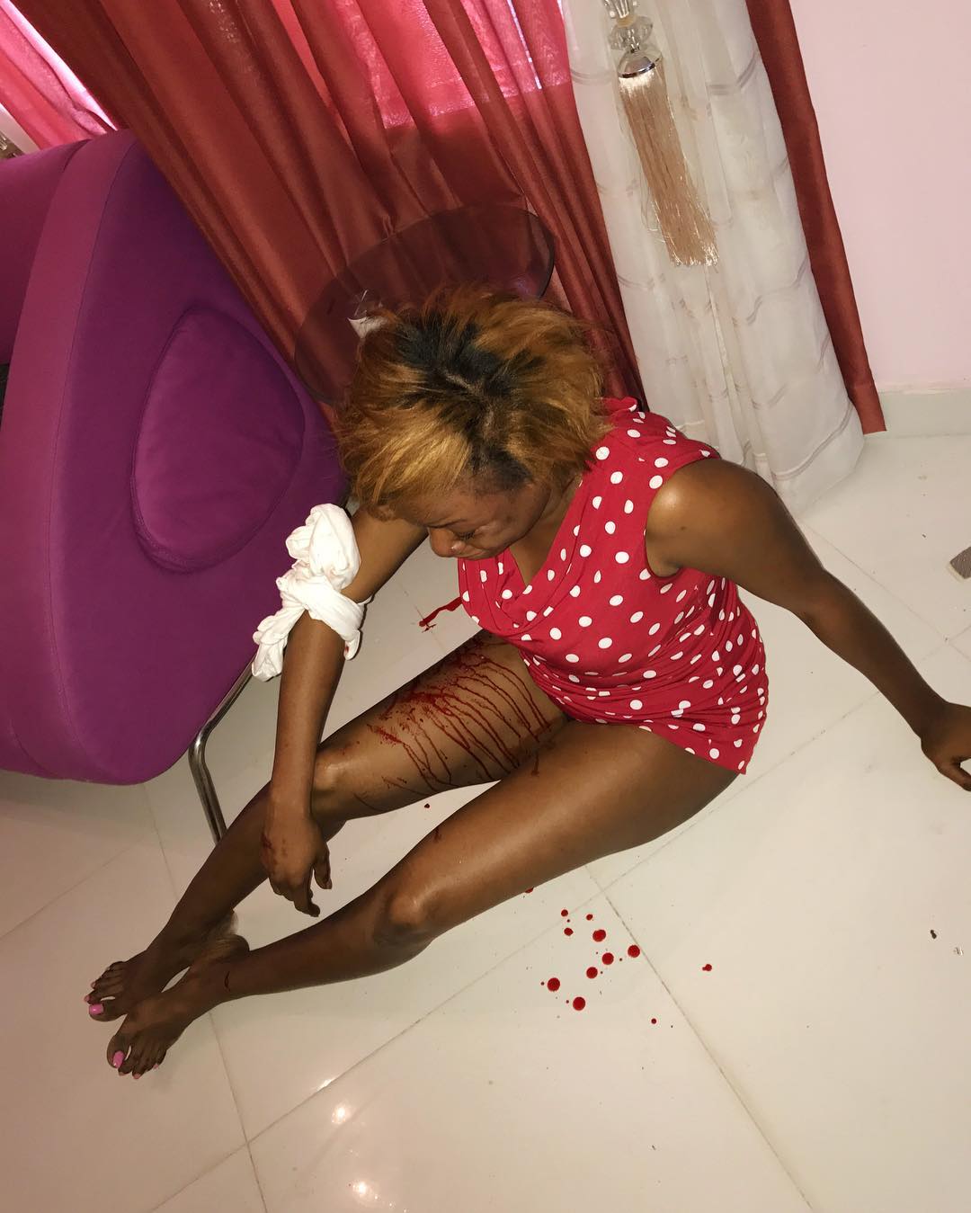 Patoranking's Record Label Owner Fuston Allegedly Beats Up Wife Till She Bleeds But She Quickly Calls Him Out After He Went On Instagram To Share Motivational Quote