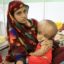 Mohammad Hasan Who Suffers From Hydrocephalus