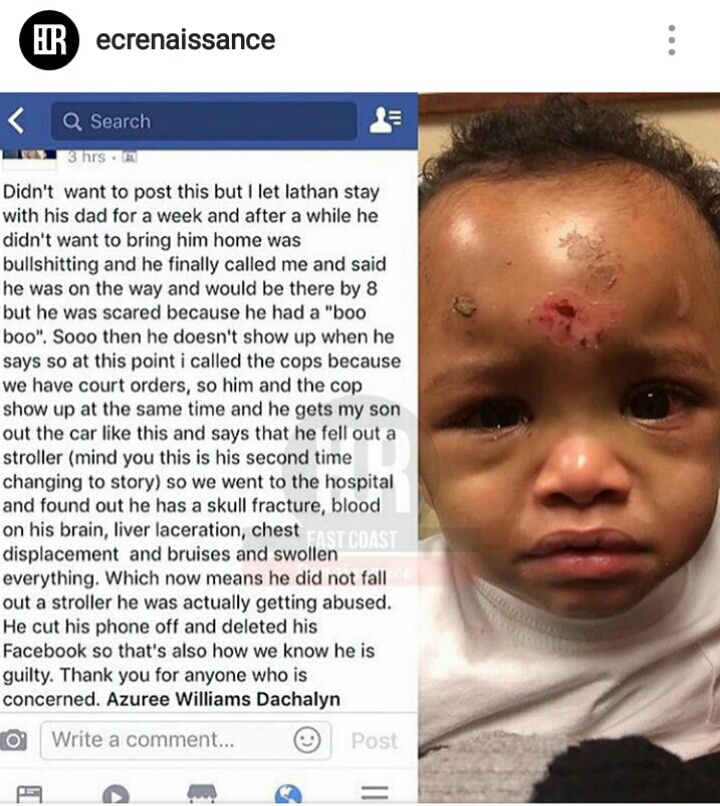Upset Mum Has Taken To Facebook To Show Visible Scars Child Suffered From The Dad, Mom, Puts Her Child’s Father On Blast For Bringing Child Home With Bruises, Child Abuse, Domestic Violence, 