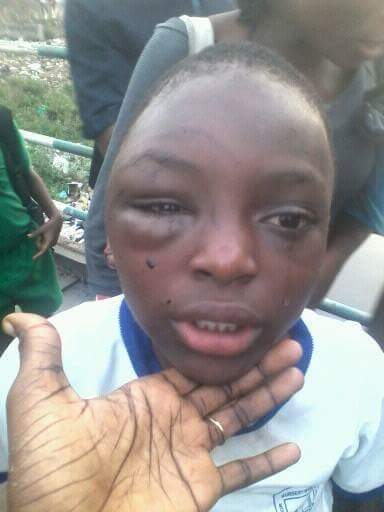See How A Father Brutally Beat His Daughter In Sickening Child Abuse