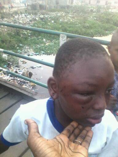 See How A Father Brutally Beat His Daughter In Sickening Child Abuse