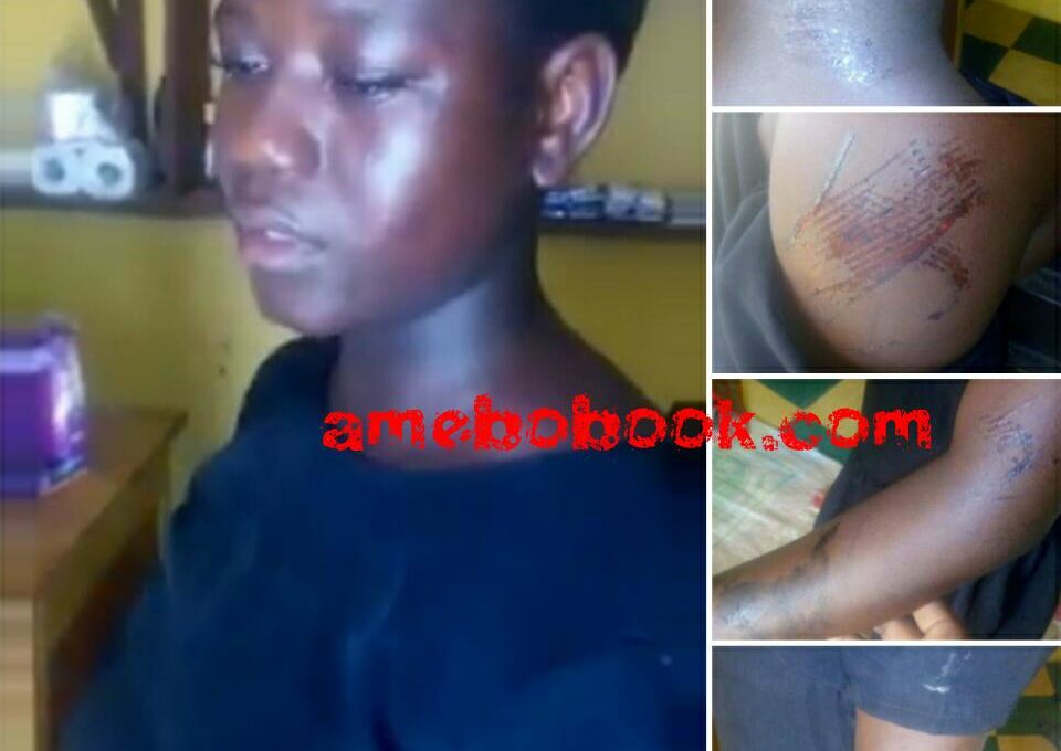Girl Brutalized By Employer For Eating Food With Meat In Ikorodu