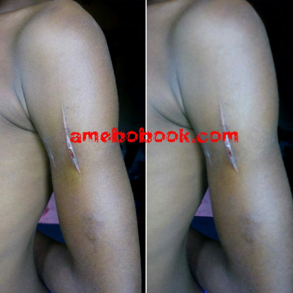 11-Year-Old Girl That Was Beaten And Stabbed With Kitchen Knife After She Took Beans From The Pot And Ate When Hungry