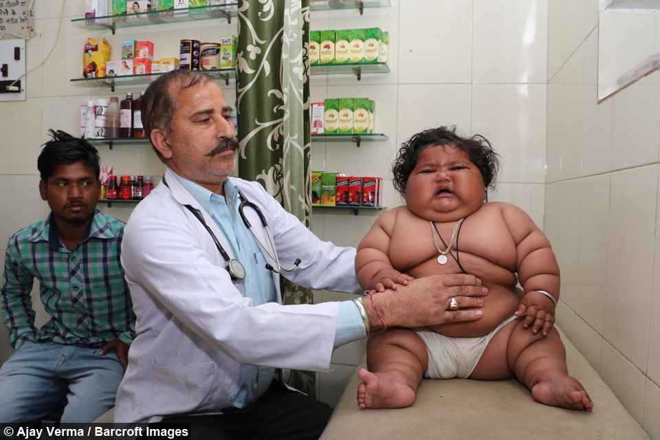 Giant 8-Month-Old Baby That Weighs 38LBS 6