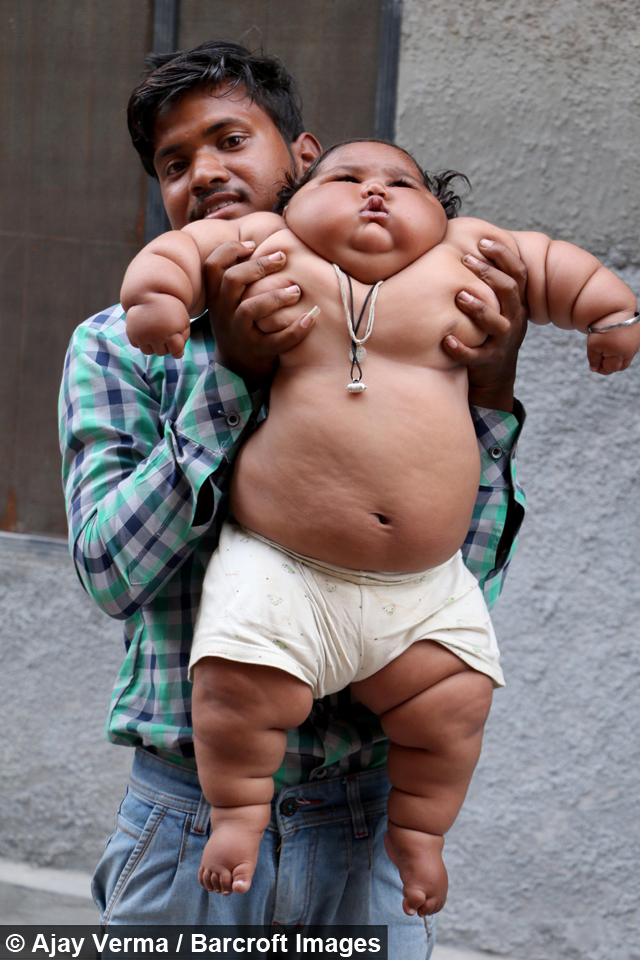 Giant 8-Month-Old Baby That Weighs 38LBS 5