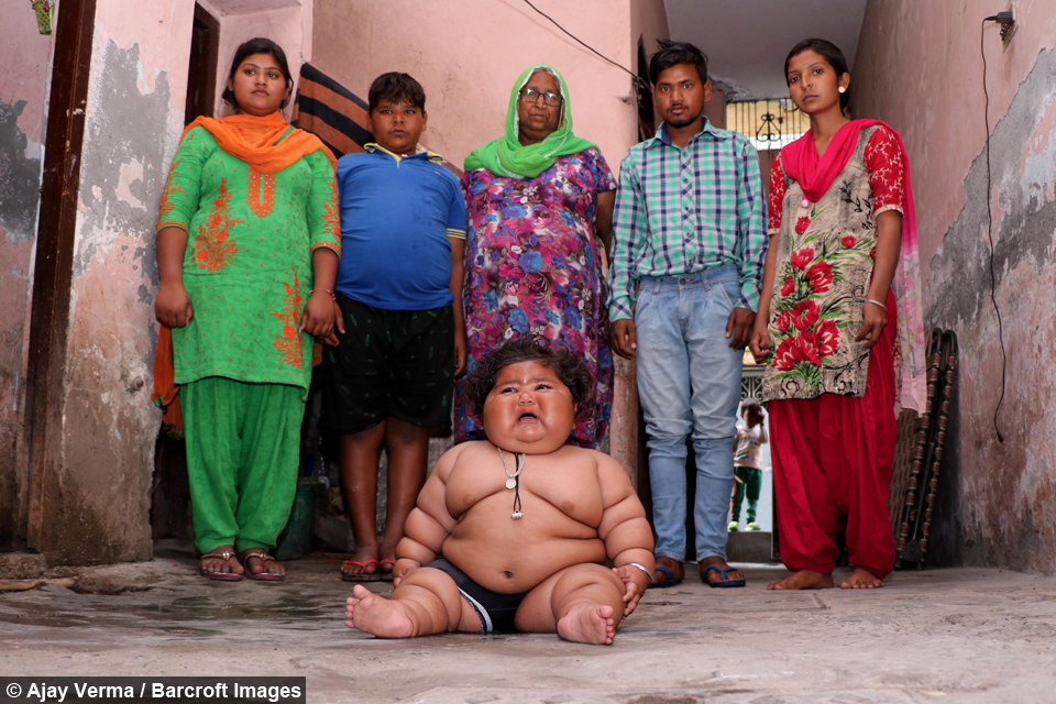 Giant 8-Month-Old Baby That Weighs 38LBS 7