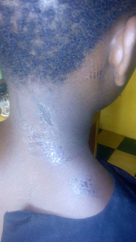 Girl Brutalized By Employer For Eating Food With Meat In Ikorodu 4