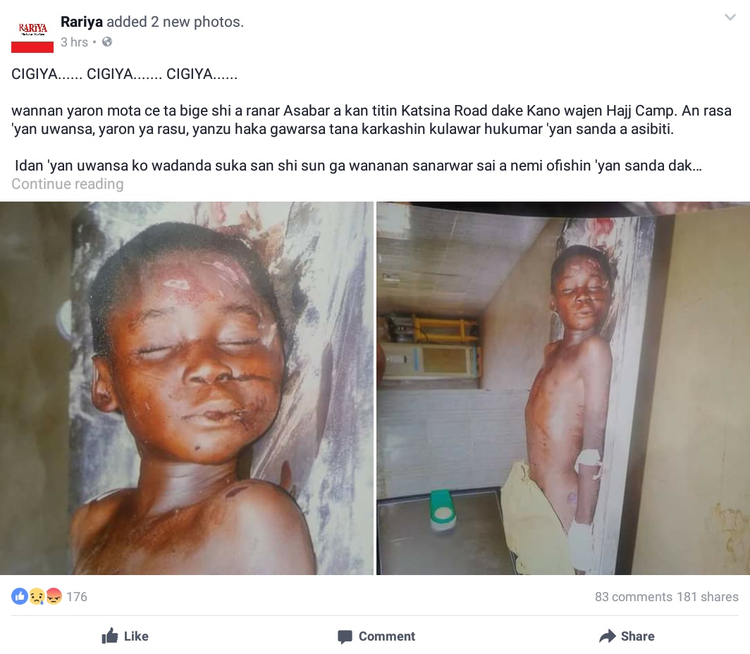 Unidentified Child Has Been Killed By A Car In Kano 2