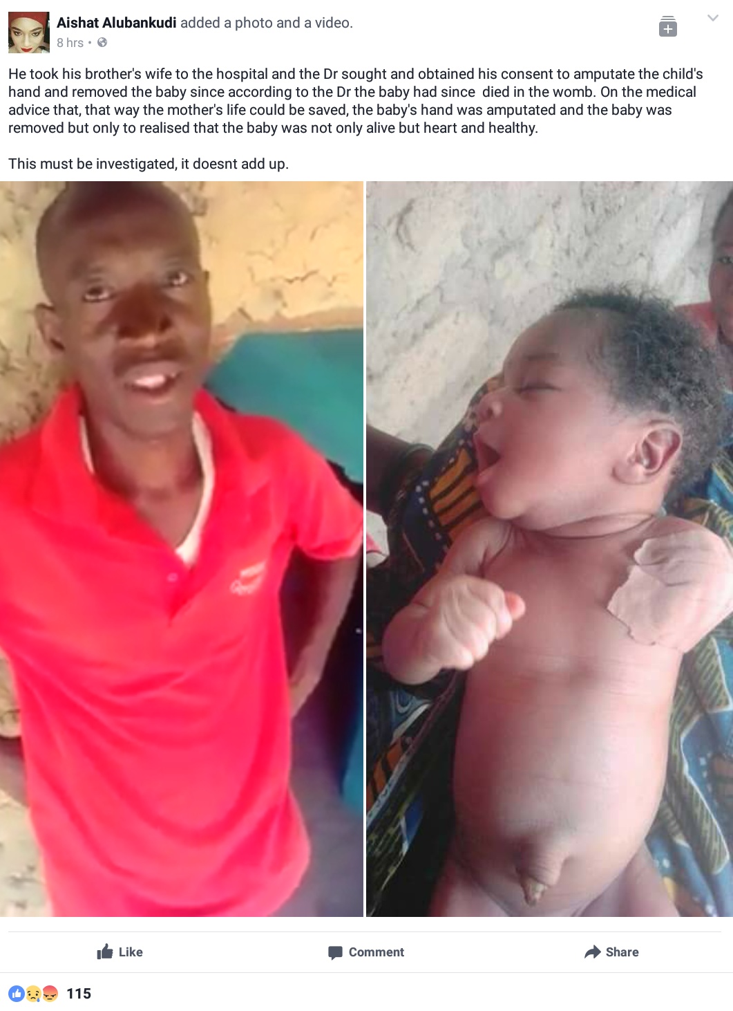 Doctor In Northern Part Of Nigeria Declares Unborn Baby Dead Then Goes Ahead To Amputate His Arm After Obtaining Consent Only For The Baby To Be Brought Out Alive 5