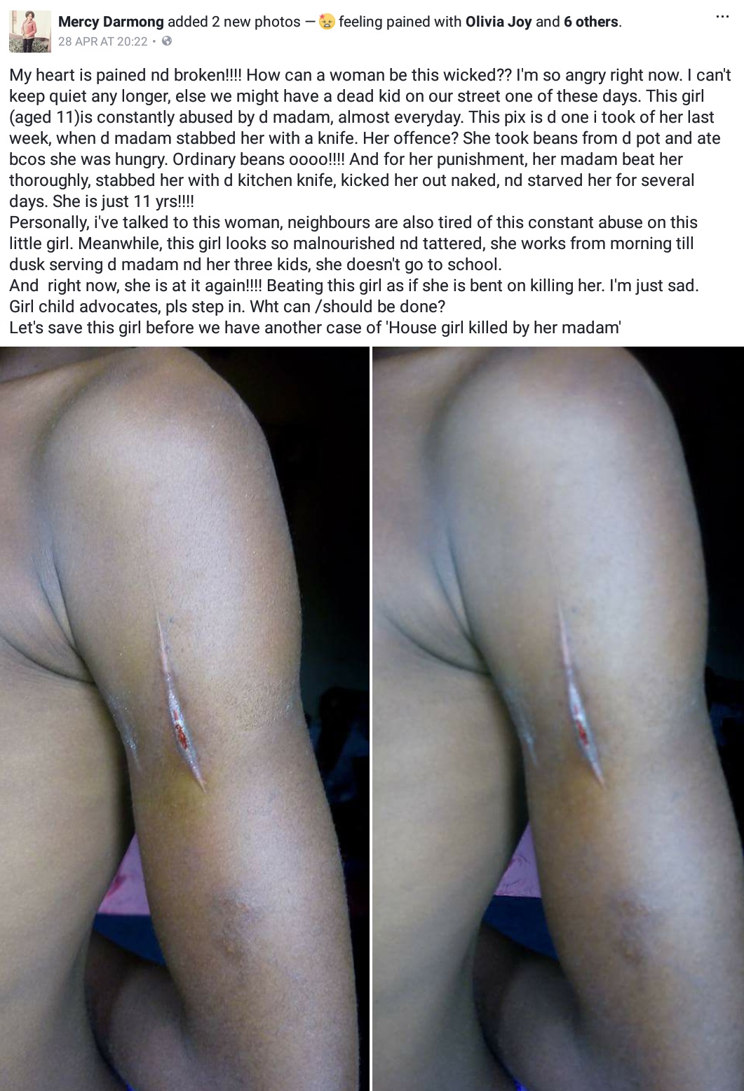 11-Year-Old Girl That Was Beaten And Stabbed With Kitchen Knife After She Took Beans From The Pot And Ate When Hungry 1