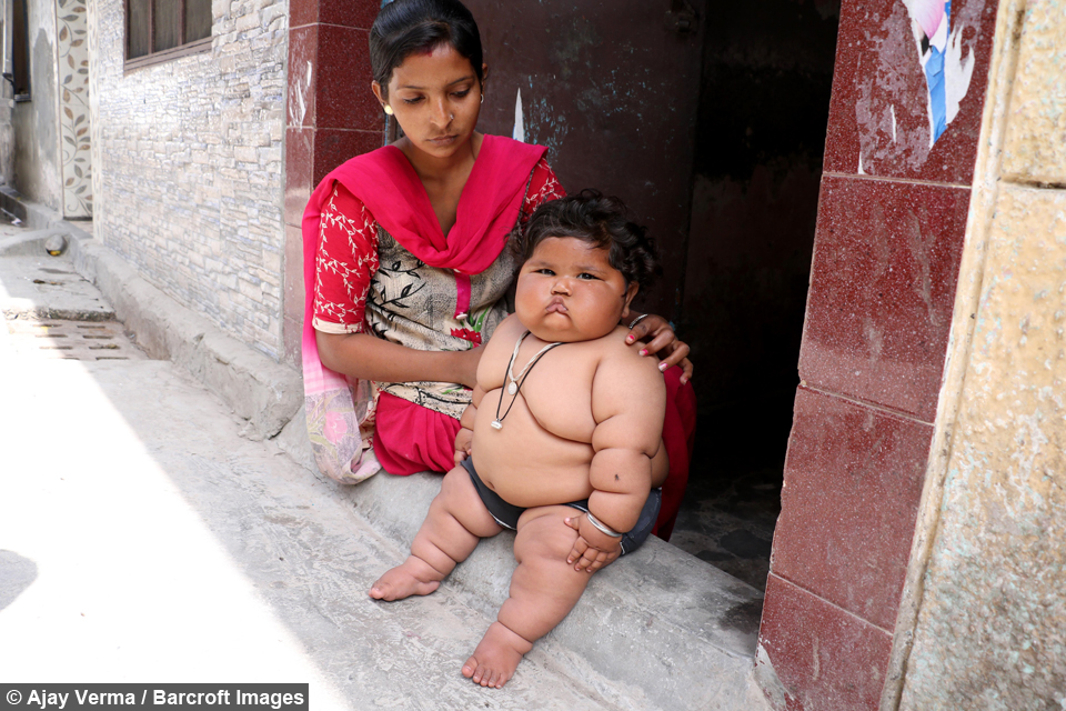 Giant 8-Month-Old Baby That Weighs 38LBS 4