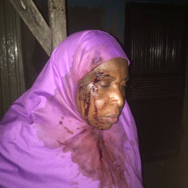 mss_sashs Shares Photos Of Woman Brutalized By Stepchildren While Trying To Kill Her In Anguwan Rimi kaduna 2