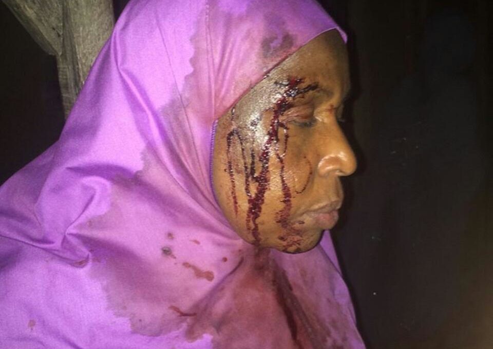 mss_sashs Shares Photos Of Woman Brutalized By Stepchildren While Trying To Kill Her In Anguwan Rimi, Kaduna