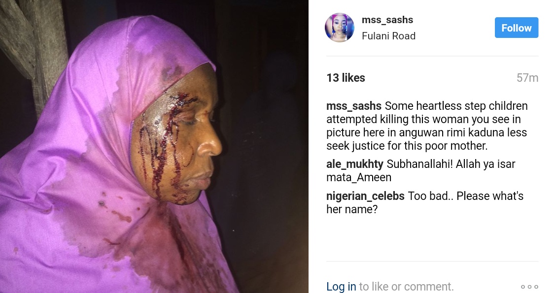 mss_sashs Shares Photos Of Woman Brutalized By Stepchildren While Trying To Kill Her In Anguwan Rimi kaduna 