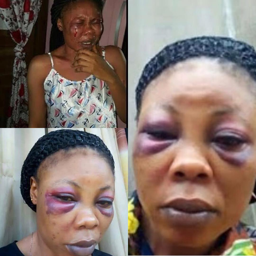 Domestic Violence Victim Mercy Aigbe (1)