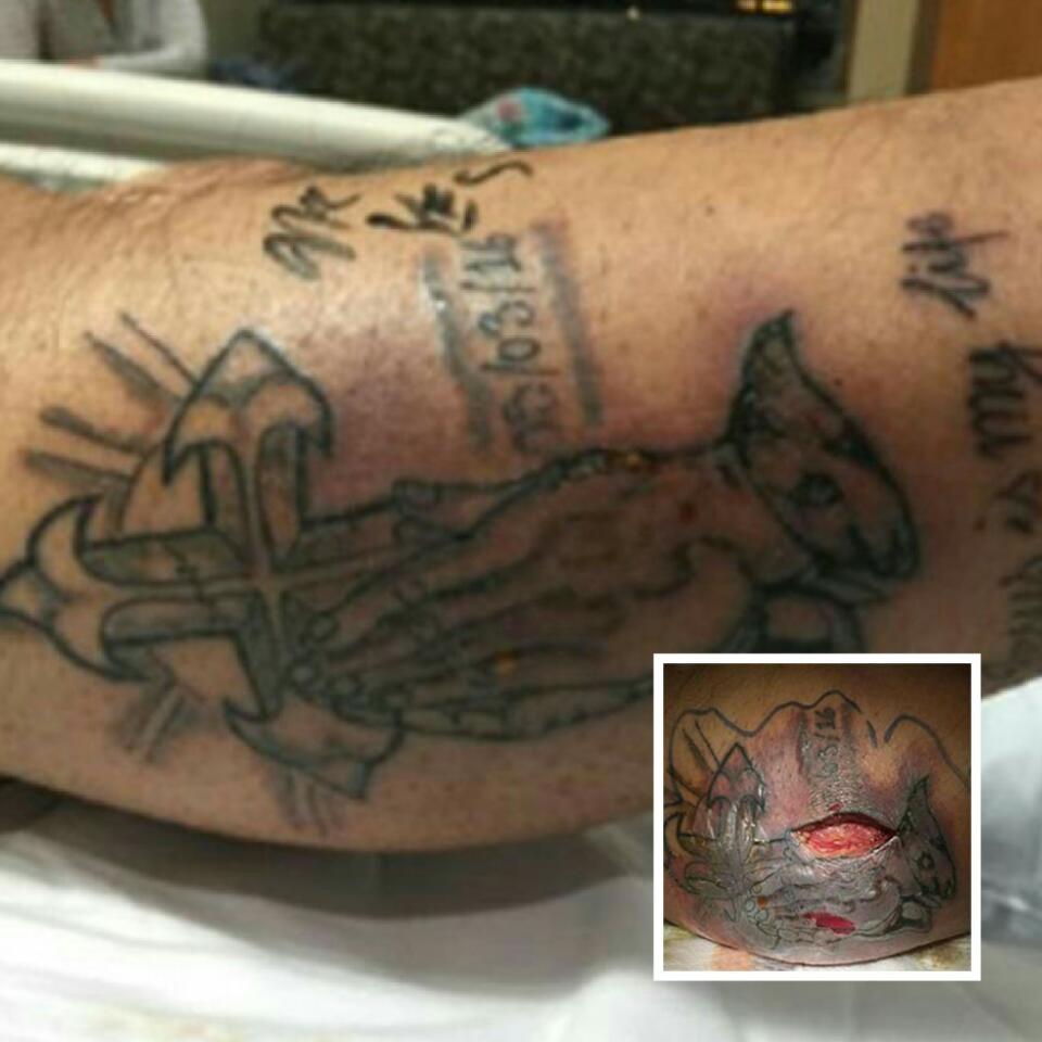 Man Who Got New Tattoo Died From Septic Shock After He Ignored Advice To Wait For Two Weeks Before Swimming