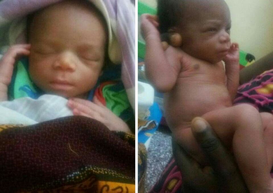 HIV-Positive Baby That Was Abandoned Along The Road In Benin City