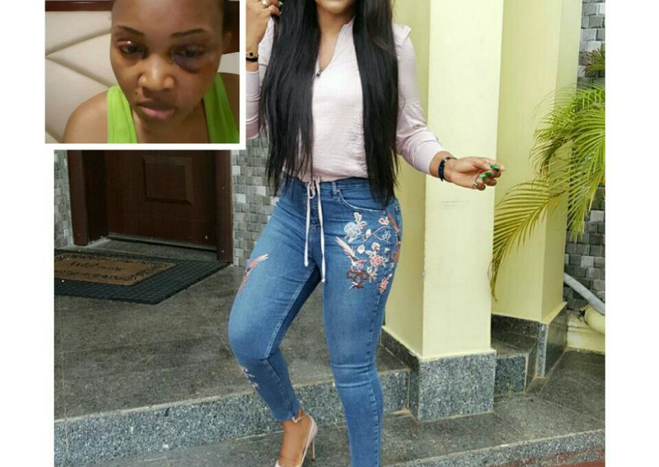 Mercy Aigbe Shared A Throwback Photo Of Brutalized Face By Larry Gentry