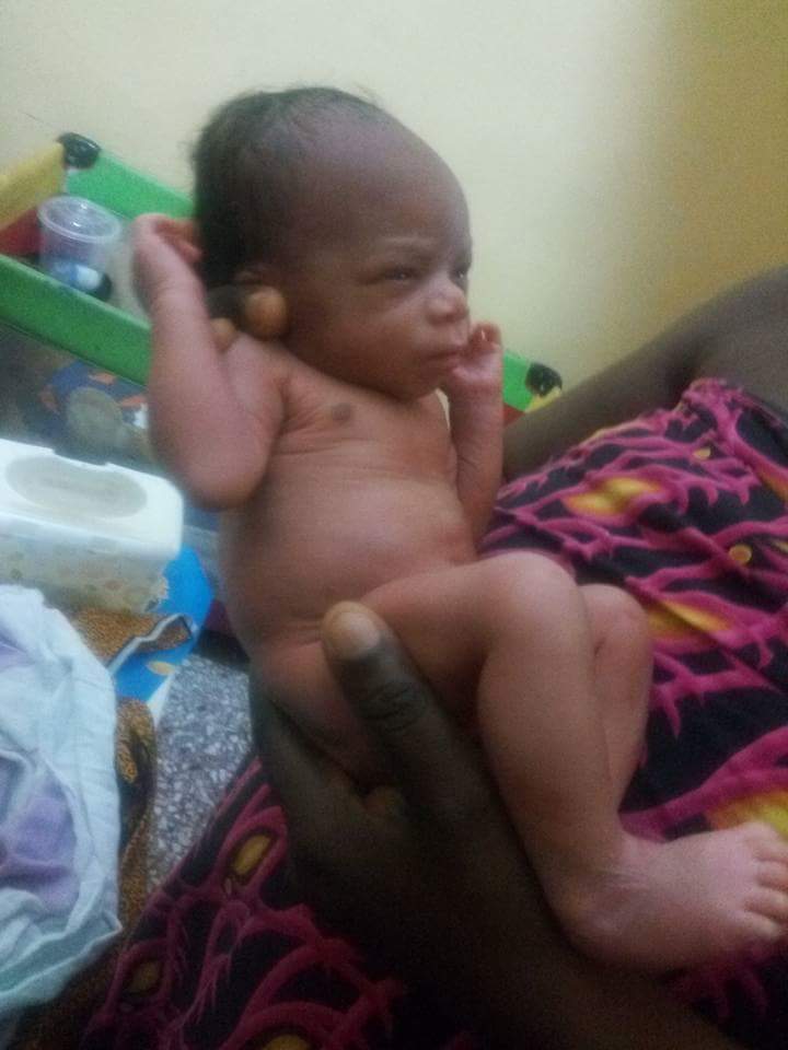 HIV-Positive Baby That Was Abandoned Along The Road In Benin City (4) 