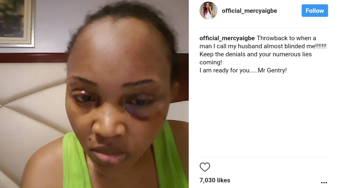 Mercy Aigbe Shared A Throwback Photo Of Brutalized Face By Larry Gentry (1) 