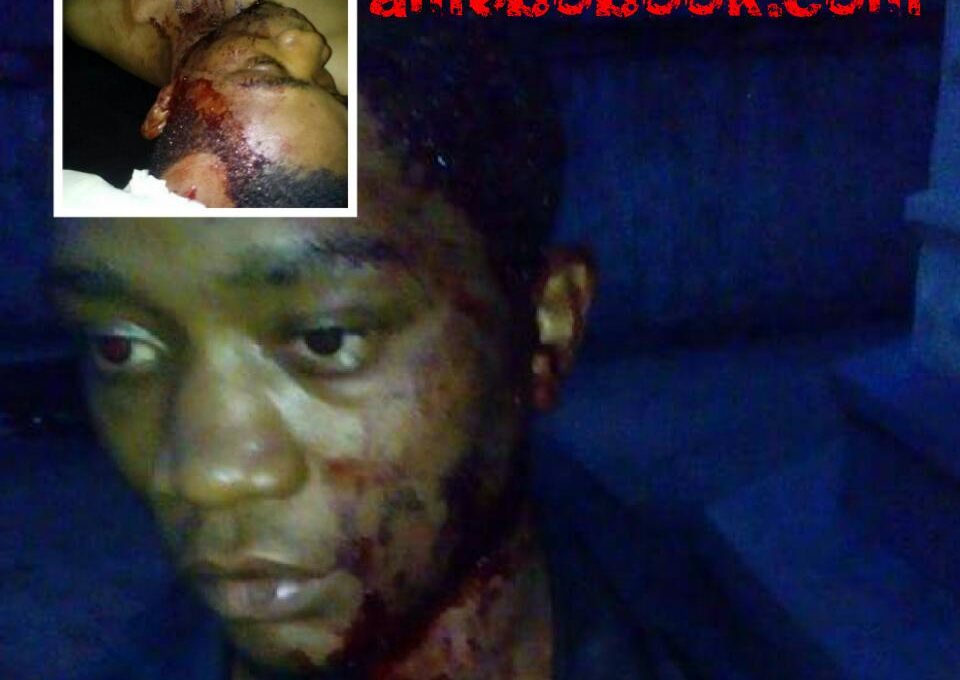 Vigilante Beat And Stabbed This Man With Broken Bottle In Onitsha