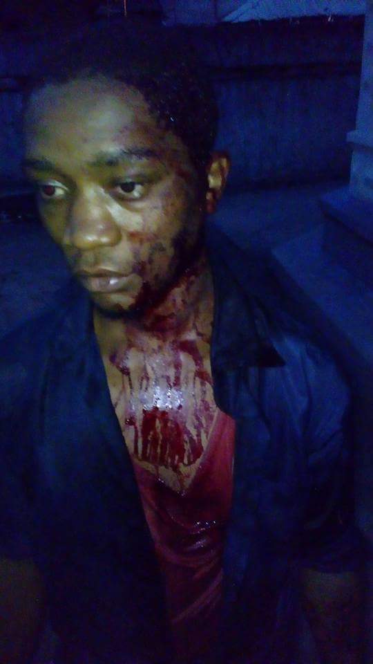 Vigilante Beat And Stabbed This Man With Broken Bottle In Onitsha