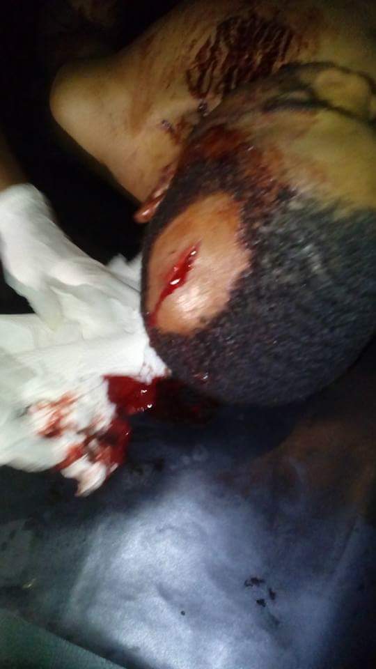 Vigilante Beat And Stabbed This Man With Broken Bottle In Onitsha (2) 