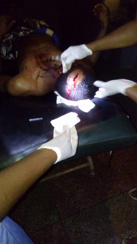 Vigilante Beat And Stabbed This Man With Broken Bottle In Onitsha (3) 