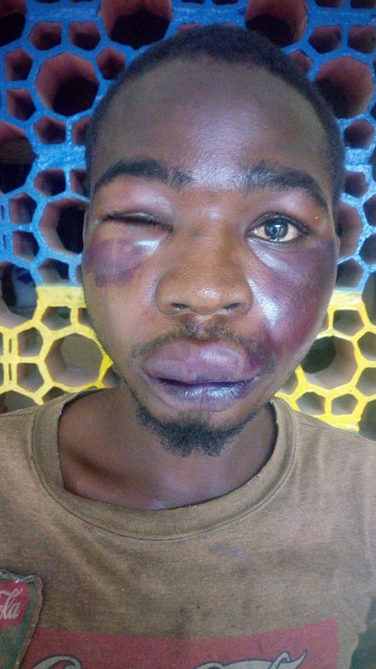 Man Was Savagely Beaten Up After He Called Someone 'Mad Man' In Kano State