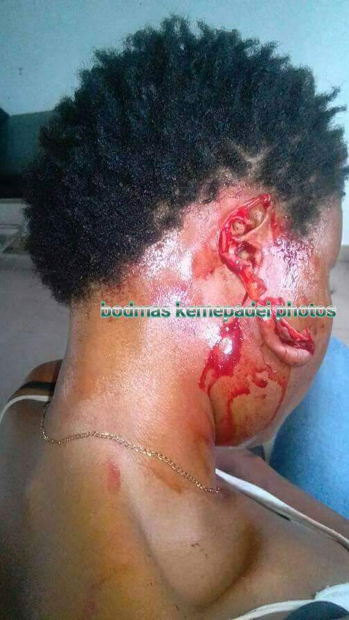 Jealous Lover Bit Off The Ear Of Her Rival In Bayelsa (1)