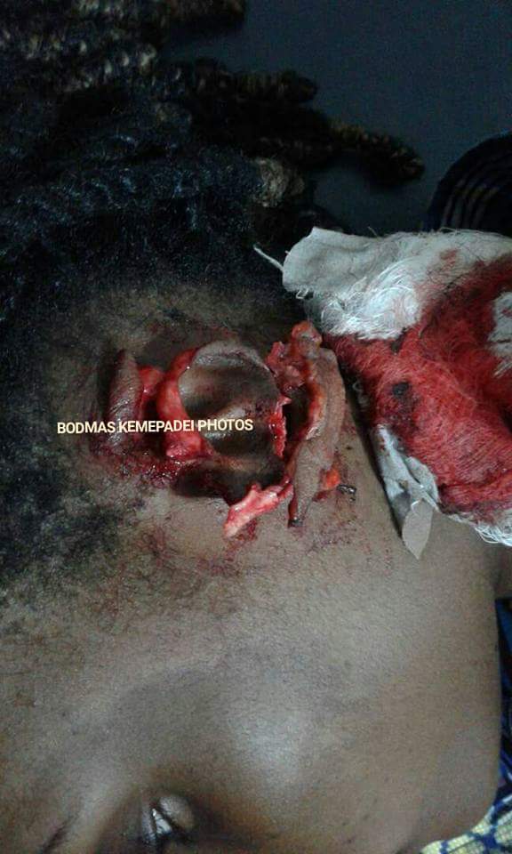 Jealous Lover Bit Off The Ear Of Her Rival In Bayelsa (2)