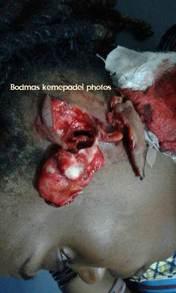 Jealous Lover Bit Off The Ear Of Her Rival In Bayelsa (3)