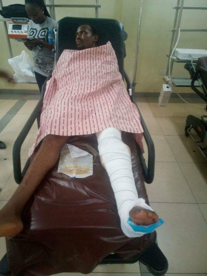 Two Policemen Fighting With Guns Accidentally Shoot Man Married For 5 Weeks In The Leg In Wuse 2 (2)