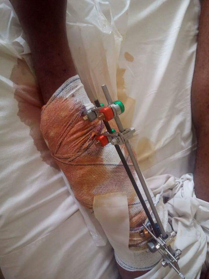 Two Policemen Fighting With Guns Accidentally Shoot Man Married For 5 Weeks In The Leg In Wuse 2 (4)