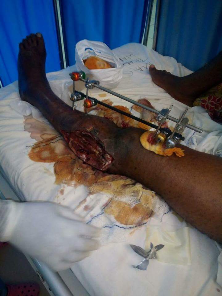 Two Policemen Fighting With Guns Accidentally Shoot Man Married For 5 Weeks In The Leg In Wuse 2 (3)