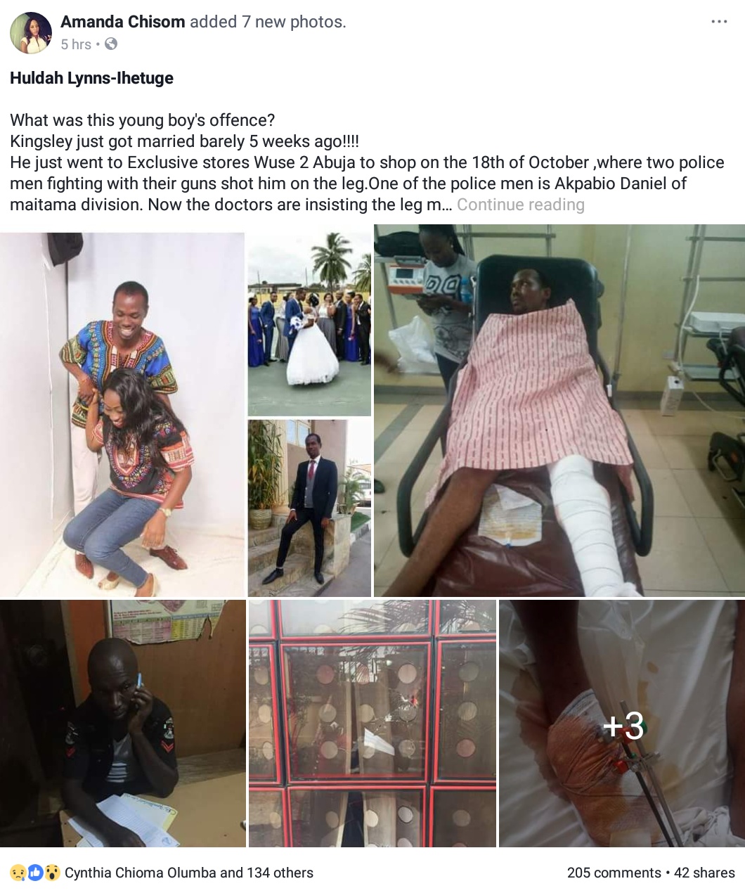 Two Policemen Fighting With Guns Accidentally Shoot Man Married For 5 Weeks In The Leg In Wuse 2 (6)