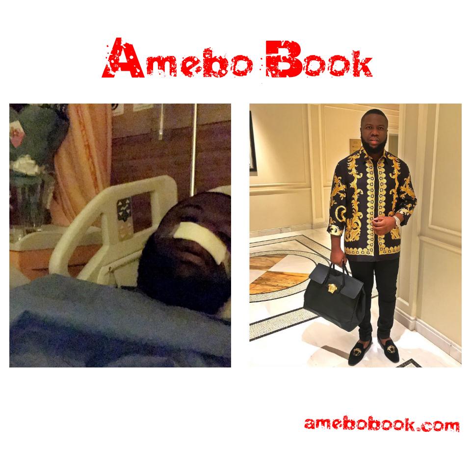 Nigerians Troll Hushpuppi After He Underwent Surgery