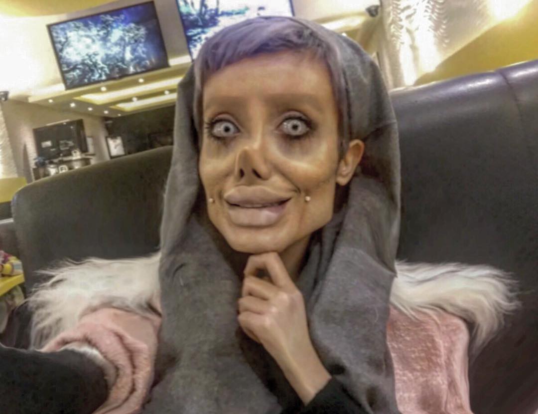 Iranian Teen Has Undergone 50 Surgeries To Look Like Her Idol Angelina Jolie (2)