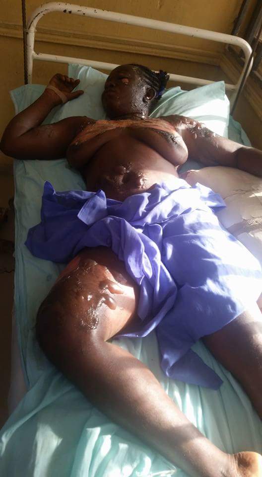 Man Poured Hot Boiling Oil On His Wife In Nasarawa State (3)