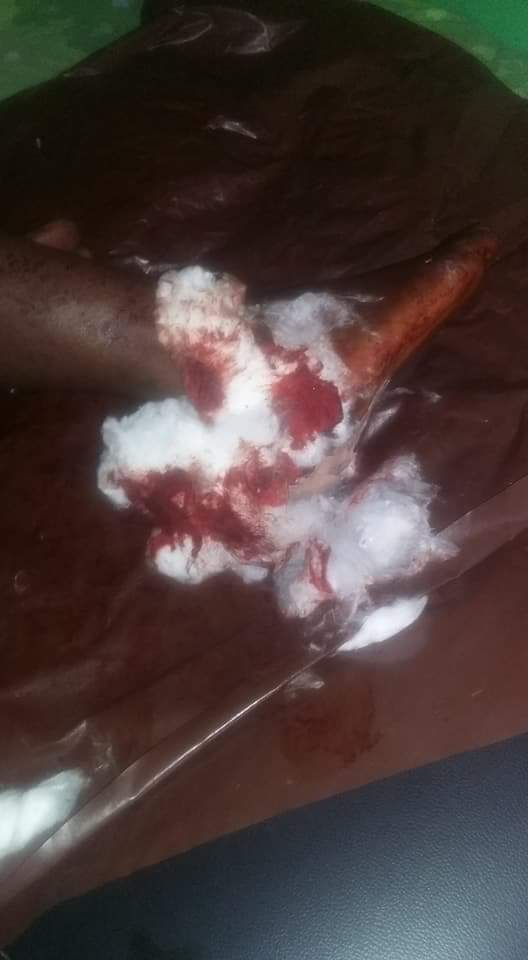 Nigerian Policeman Mistakenly Shoots Innocent Passerby After Missing Taxi Driver Who Refused To Give Him N50 In Port Harcourt (4)