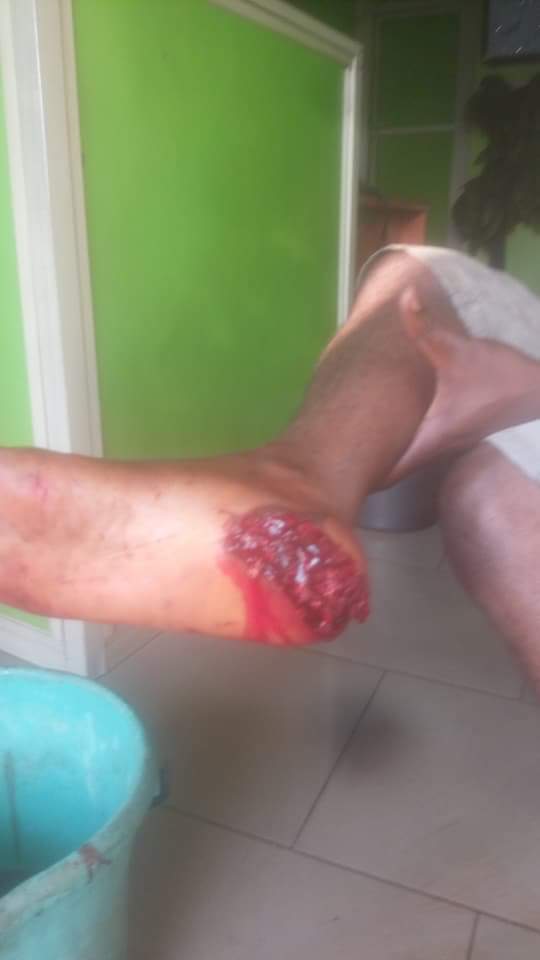 Nigerian Policeman Mistakenly Shoots Innocent Passerby After Missing Taxi Driver Who Refused To Give Him N50 In Port Harcourt (5)