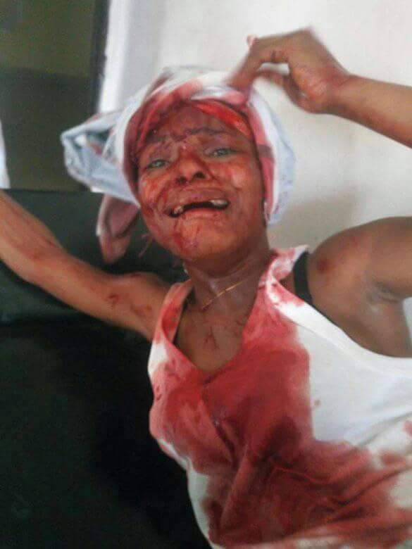 Lady Stabbed Her Younger Sister Because She Refused To Drop Out Of School In Delta State (3)