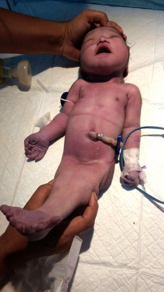 Muskura Bibi: Mum Gave Birth To 'Real Life Mermaid' Baby With Fused Legs (3)