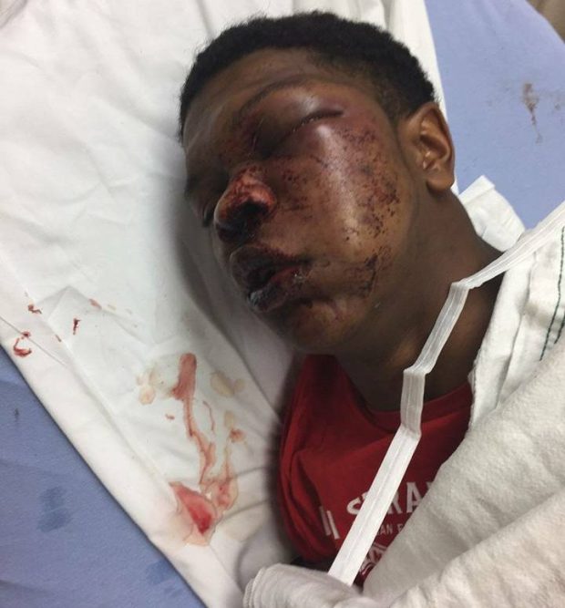 Police Officers Battered Teen Beyond Recognition Despite Being In Handcuffs