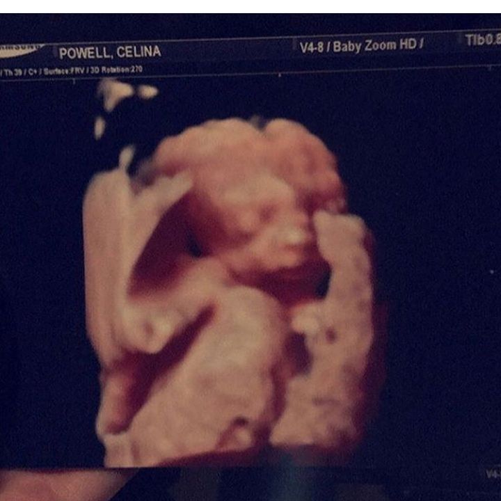 Grouie Ultrasound Photos Claiming Rapper Offset As Father (2)